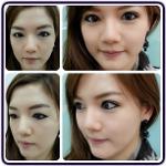 เมโสหน้าใส x dna หน้าใส ลดรอยดำ ขาวเห็นผลทันทีตั้งแต่ครั้งแรก