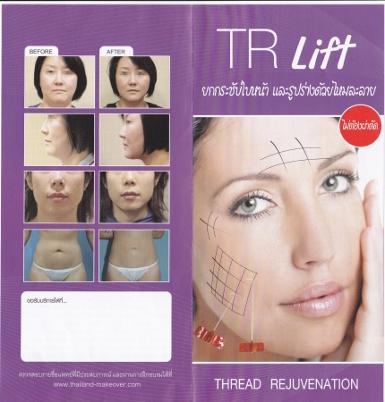 TR lift ร้อยไหมยกกระชับ ปรับรูปหน้า 